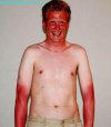 mais-comment-ce-jeune-homme-a-t-il-pu-finir-avec-un-bronzage-de-cette-couleur_4a443dce72f30ed4...jpg