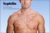 what-are-the-symptoms-of-syphilis.jpg